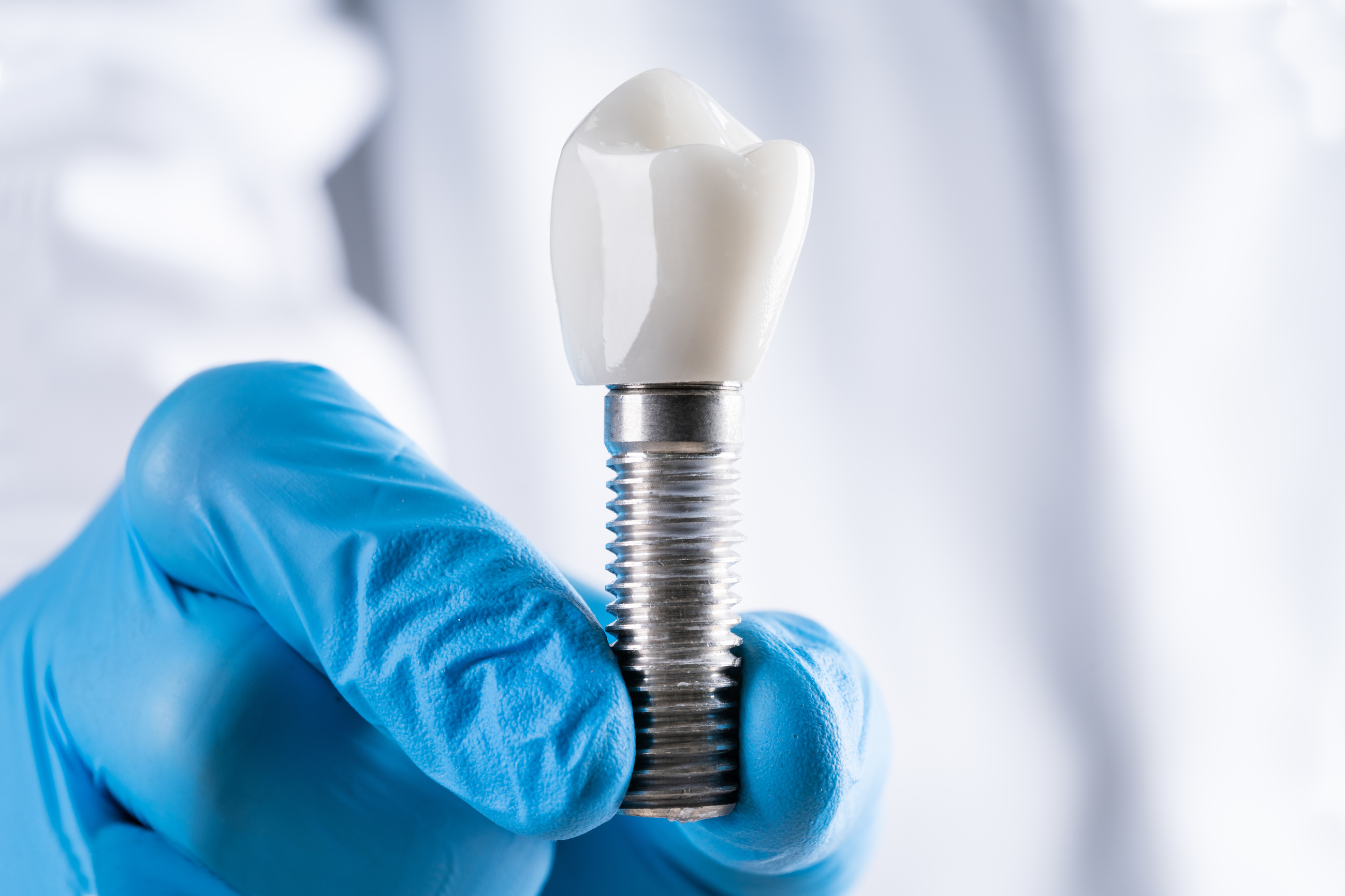 Dentist Showing Dental Tooth Implant Model